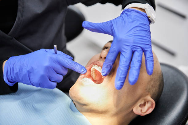 Best Emergency Treatment for Oral Infections in Lakeview, CA